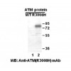 ATM(R3008H) 小鼠單抗/武漢現貨