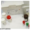 甲型流感H1荧光PCR试剂盒