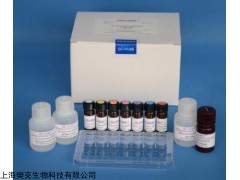 48T/96T 人甲状腺抗体（TAb）ELISA试剂盒实验原理