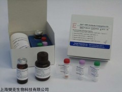 48T/96T 人糖皮质激素受体β(GR-β)ELISA试剂盒价格