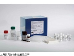 <span style="color:#FF0000">48T/96T 人乙酰胆碱受体抗体ELISA试剂盒价格</span>