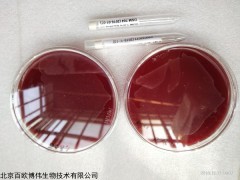 ATCC 20542土曲霉 ATCC菌種保藏中心