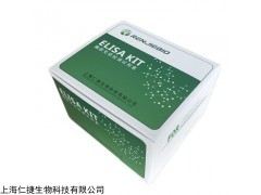 人MLCKELISA試劑盒實(shí)驗(yàn)檢測(cè)