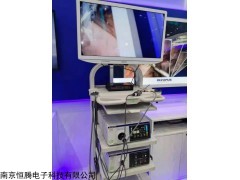 CV-170 奧林巴斯電子支氣管鏡高清窄帶成像