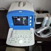 黑白B超LCD笔记本便携全数字超声诊断仪