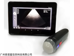 UProbe 扇掃探頭式無線B超自帶wifi傳輸?shù)绞謾C平板顯示