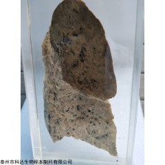 大体标本 病理大体标本