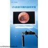 YG-2301 山东内窥镜仪器 高清便携式可视采耳仪器